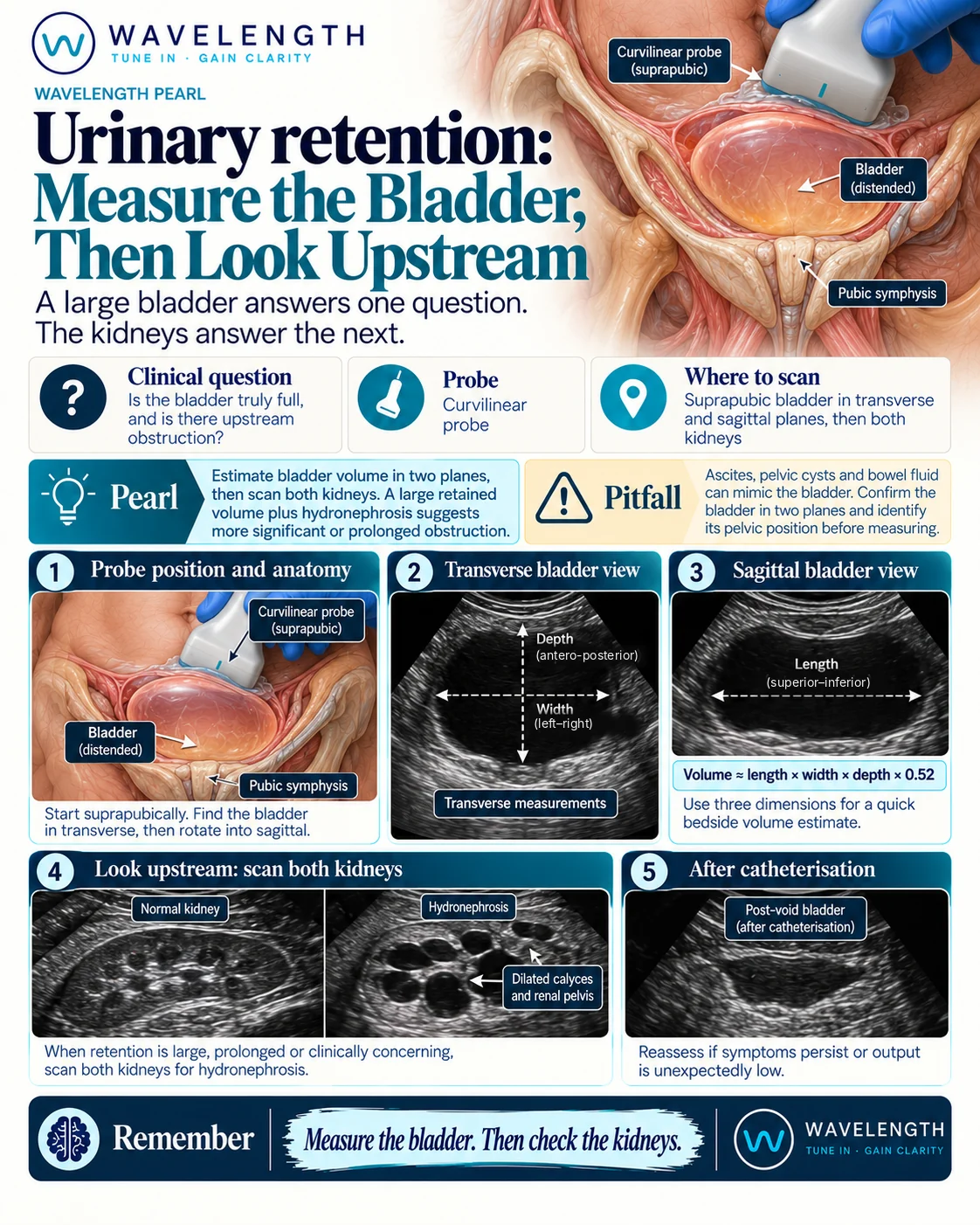 Wavelength Pearl: urinary retention. Measure the bladder in transverse and sagittal, estimate the volume, then scan both kidneys.