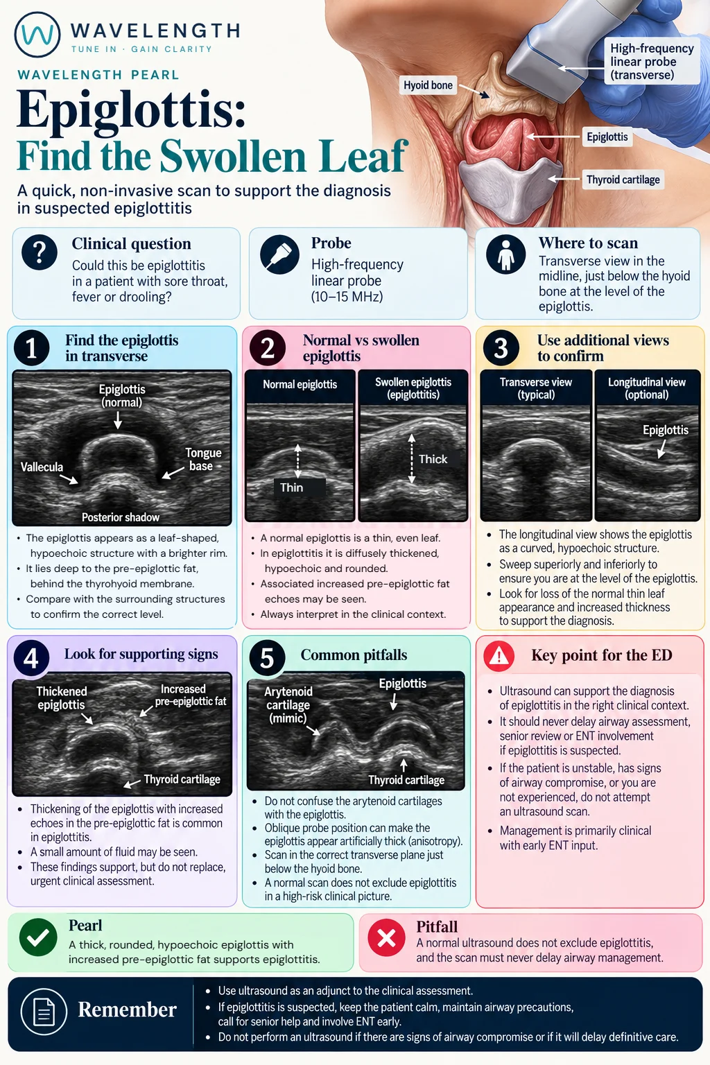 Wavelength Pearl: epiglottis. A thin normal epiglottis and a thickened, rounded epiglottis in epiglottitis, scanned in transverse above the thyroid cartilage.