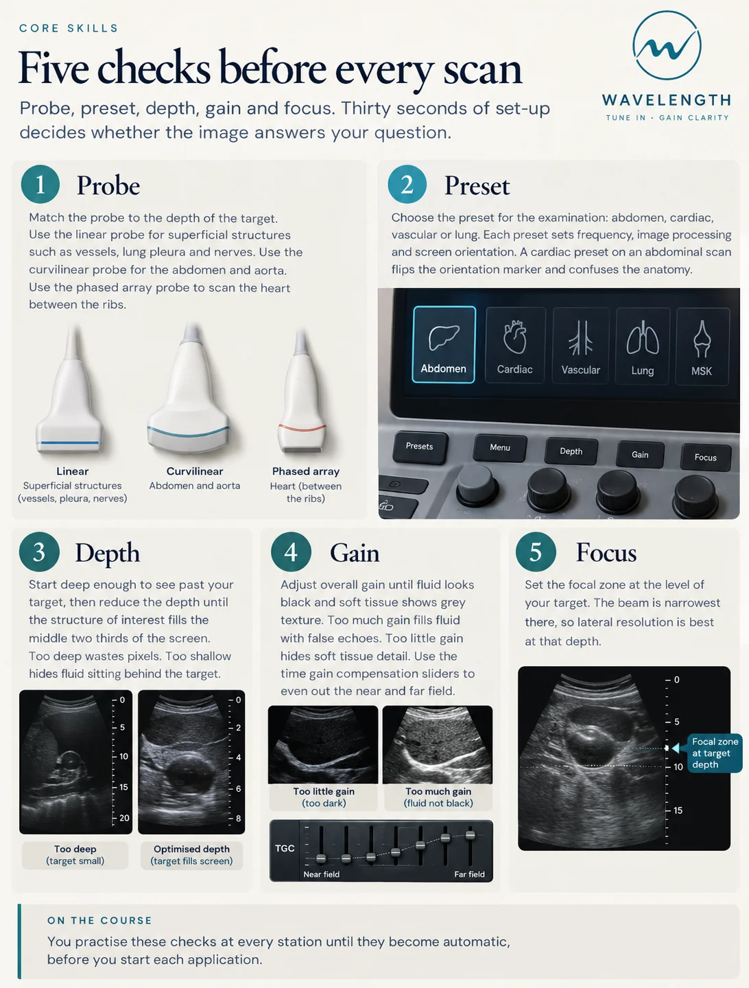 Wavelength Pearl: five checks before every scan. Probe, preset, depth, gain and focus.