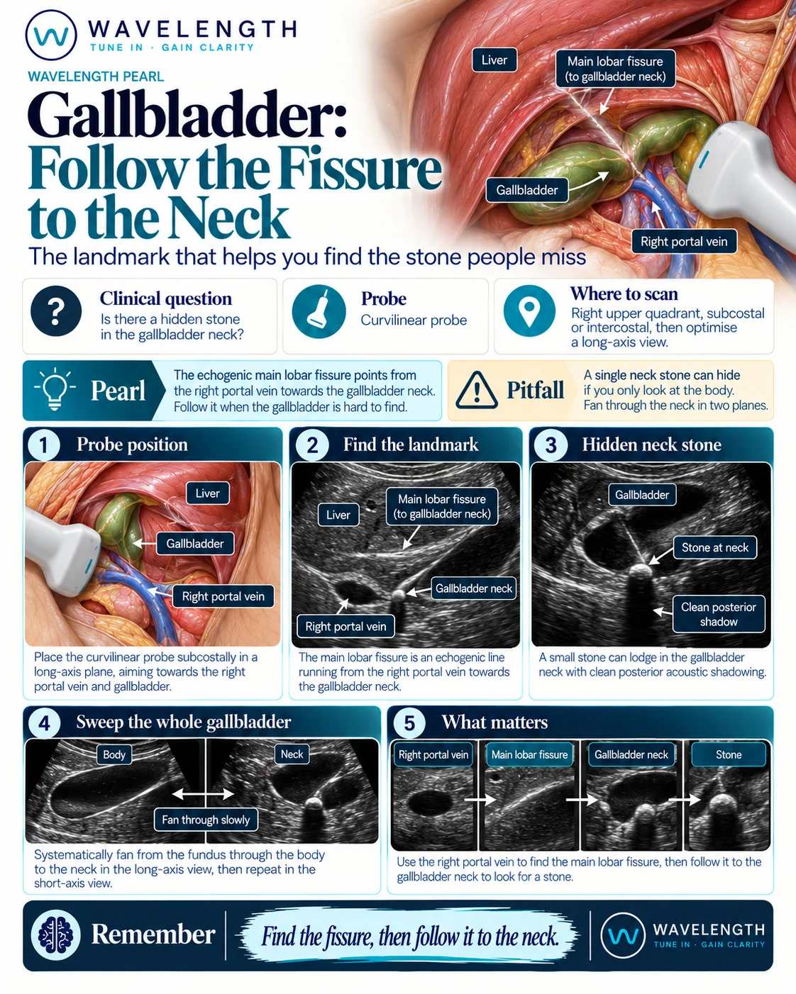 Wavelength Pearl: gallbladder. Find the portal vein, follow the main lobar fissure to the gallbladder neck, and confirm in two planes.