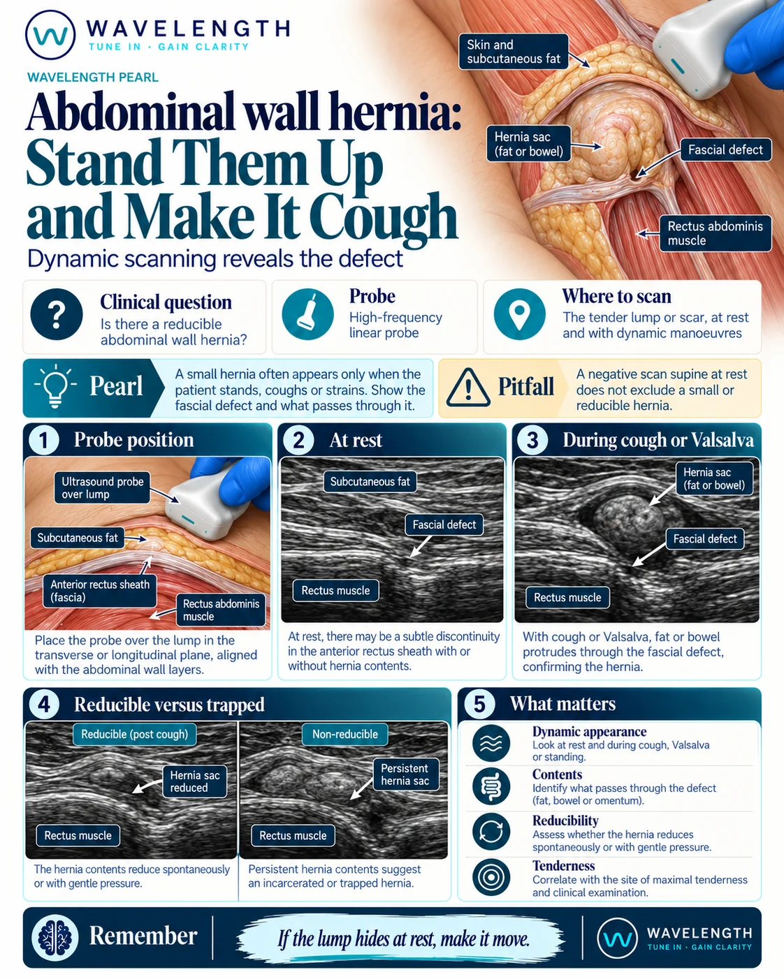 Wavelength Pearl: abdominal wall hernia. Scan at rest, then during cough or Valsalva, and check reducibility.