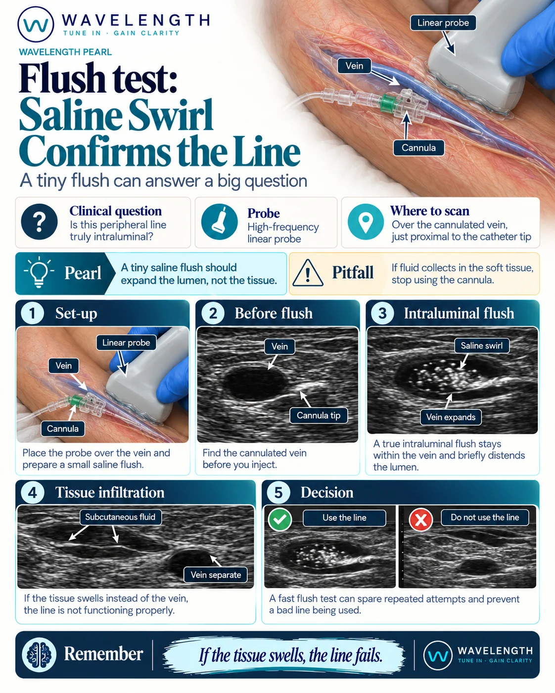 Wavelength Pearl: flush test. A small saline flush should fill the vein lumen, not the soft tissue.
