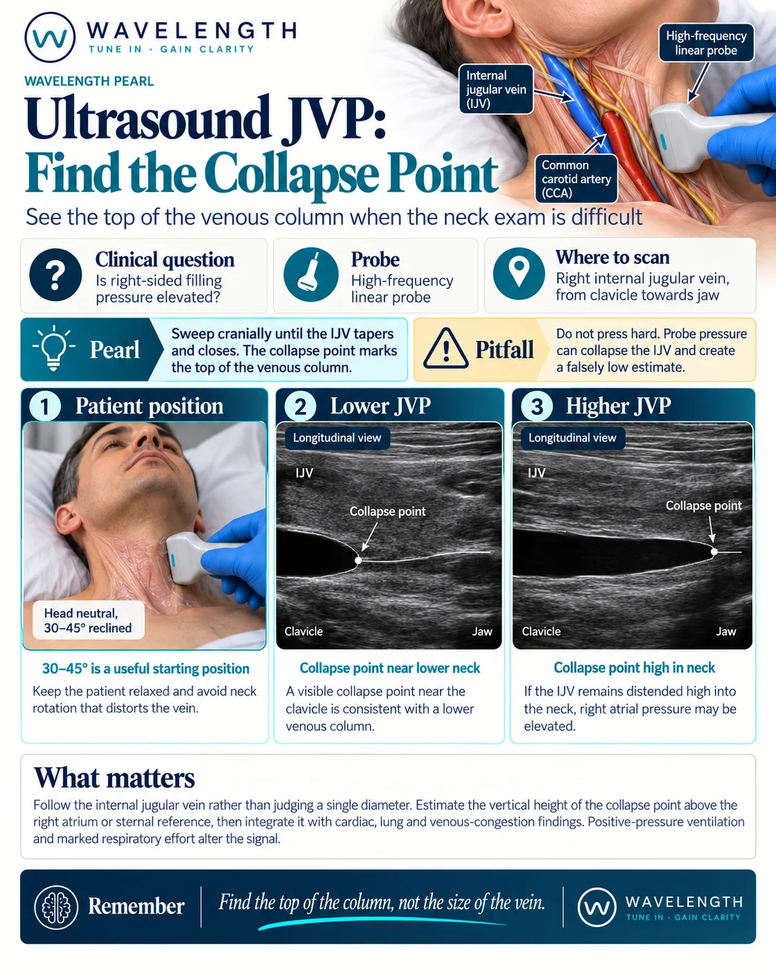 Wavelength Pearl: ultrasound JVP. Follow the right internal jugular vein up from the clavicle until it collapses. The collapse point marks the top of the venous column.