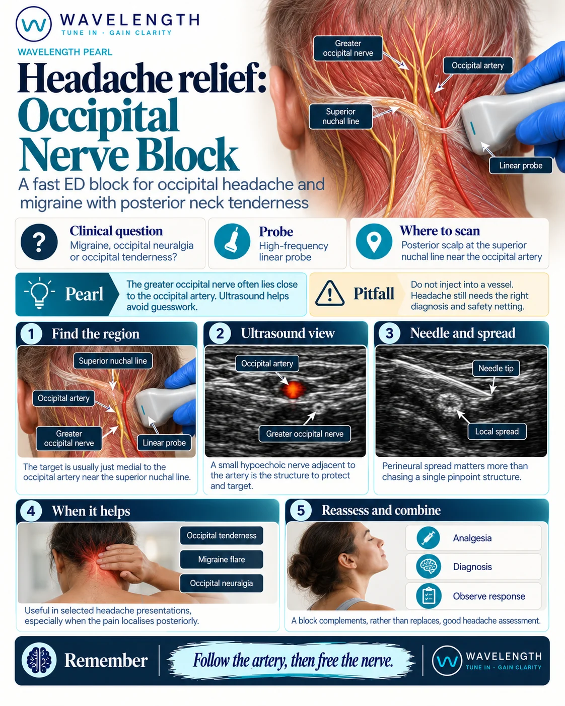 Wavelength Pearl: occipital nerve block. The greater occipital nerve often lies close to the occipital artery. Ultrasound helps avoid guesswork.