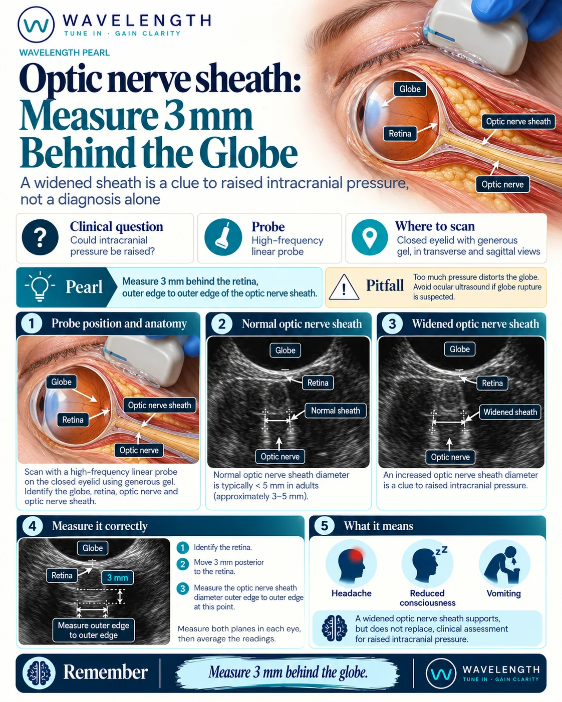 Wavelength Pearl: optic nerve sheath. Measure 3 mm behind the globe, outer edge to outer edge of the sheath.
