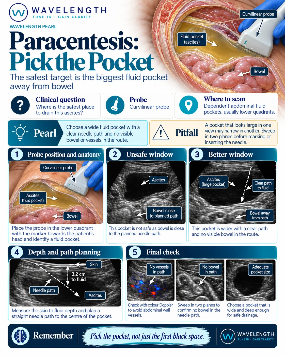 Wavelength Pearl: paracentesis. Choose the widest fluid pocket with a clear path, no bowel and no vessels in the route.