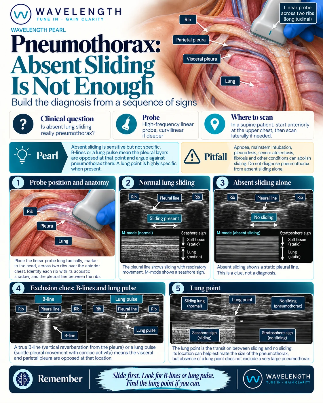 Wavelength Pearl: lung scan. B-lines and lung pulse rule out pneumothorax under the probe. A lung point confirms it.