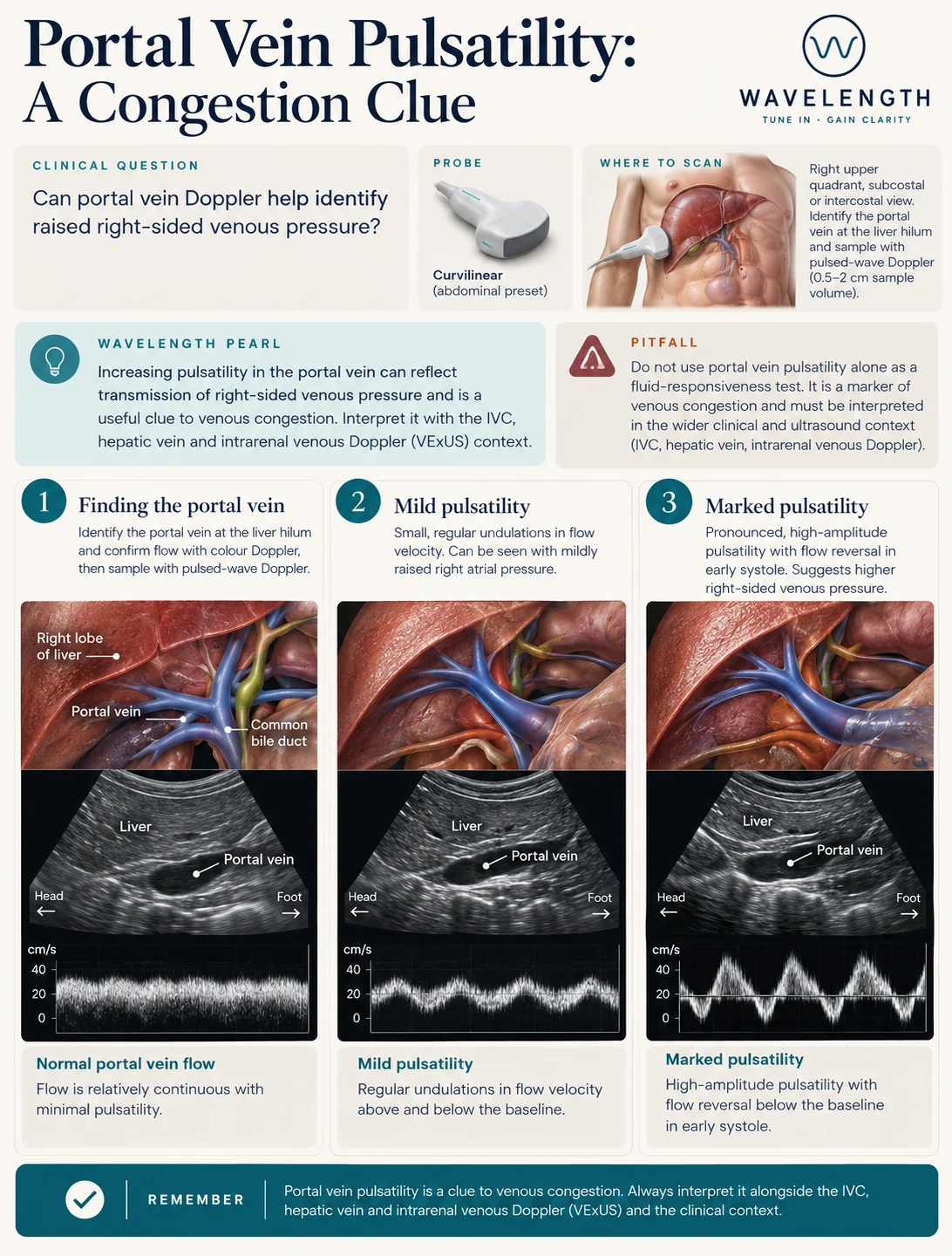 Wavelength Pearl: portal vein pulsatility. Increasing pulsatility suggests venous congestion.