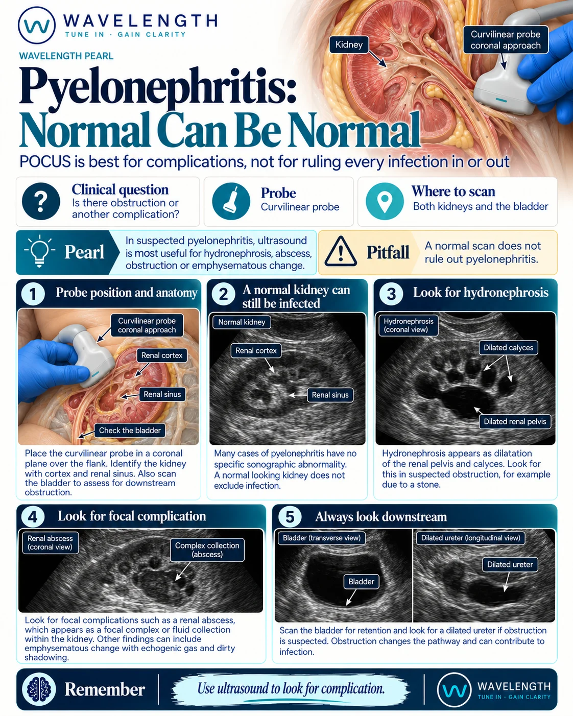 Wavelength Pearl: pyelonephritis. A normal kidney can still be infected. Look for hydronephrosis, abscess and gas, and check the bladder.