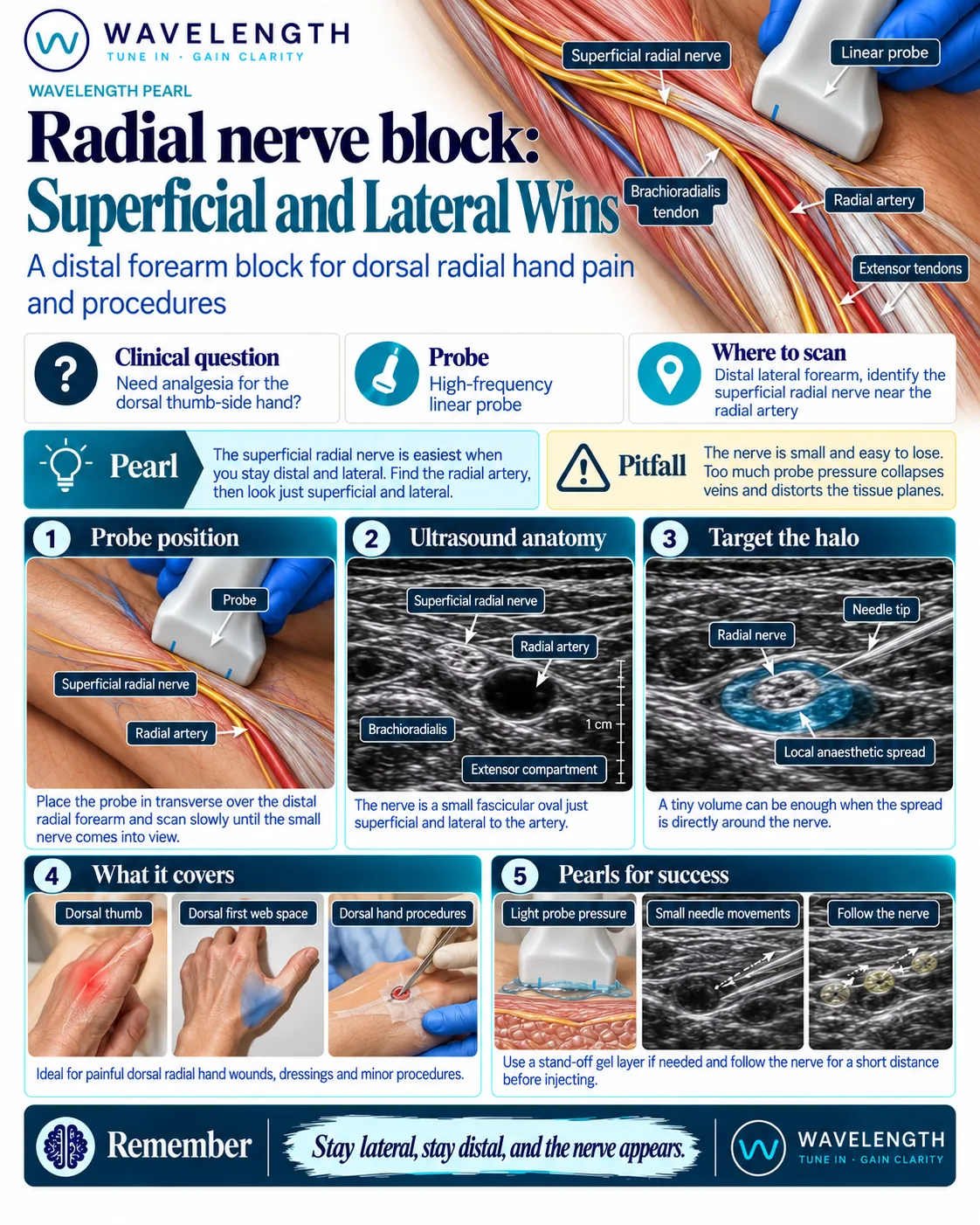 Wavelength Pearl: radial nerve block. Find the radial artery, then the small superficial radial nerve beside it, and surround the nerve with local anaesthetic.
