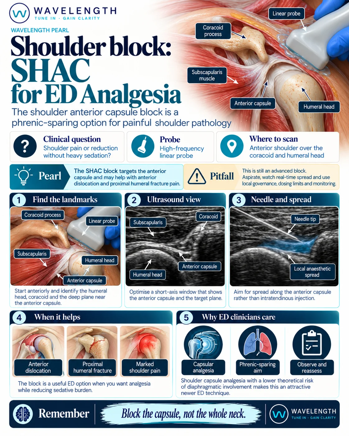 Wavelength Pearl: SHAC block. The shoulder anterior capsular block targets the anterior capsule as a phrenic-sparing option for painful shoulder pathology.