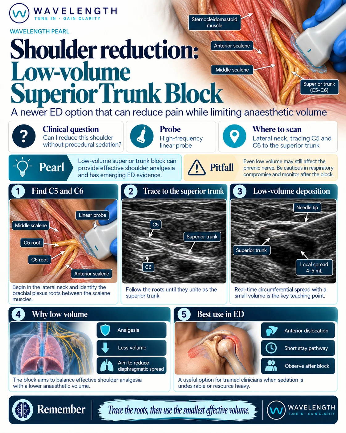 Wavelength Pearl: shoulder reduction. A low-volume superior trunk block can provide effective shoulder analgesia. Even low volume can affect the phrenic nerve.